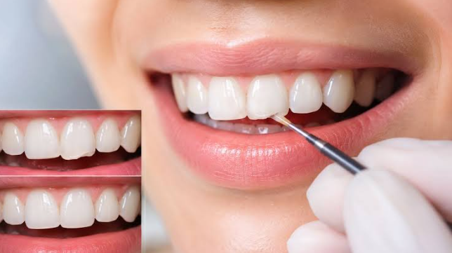 5 Smile Transformations Achieved Through Preventive And Cosmetic Care