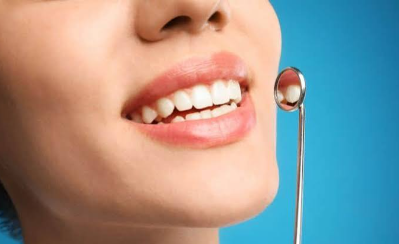 4 Cosmetic Dentistry Procedures That Improve Function And Appearance